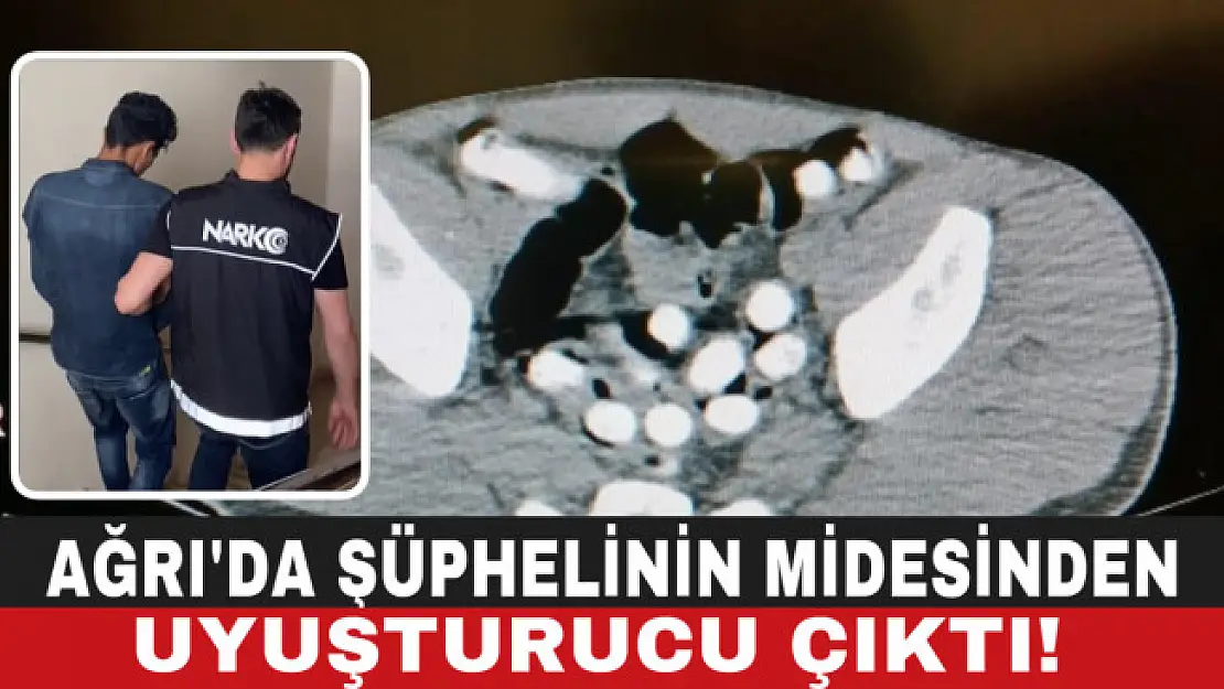 Ağrı'da şüphelinin mide ve bağırsağından 1 kilo 126 gram uyuşturucu çıktı