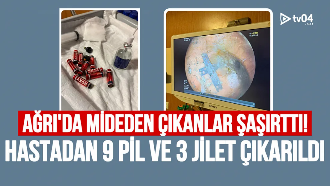 Ağrı’da mide içinde 9 pil ve 3 jilet çıkan hasta ameliyatla kurtarıldı