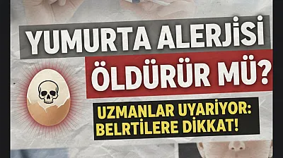 Yumurta Alerjisi Öldürür mü? Uzmanlar Uyarıyor: Anafilaksi Hayati Risk Taşıyor