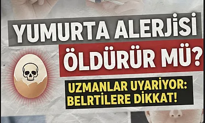 Yumurta Alerjisi Öldürür mü? Uzmanlar Uyarıyor: Anafilaksi Hayati Risk Taşıyor