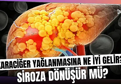 Karaciğer Yağlanması Sessizce İlerliyor: Bu Belirtileri Sakın Görmezden Gelmeyin!
