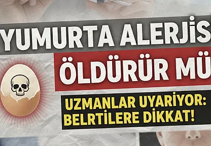 Yumurta Alerjisi Öldürür mü? Uzmanlar Uyarıyor: Anafilaksi Hayati Risk Taşıyor