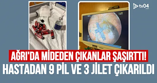 Ağrı'da mide içinde 9 pil ve 3 jilet çıkan hasta ameliyatla kurtarıldı