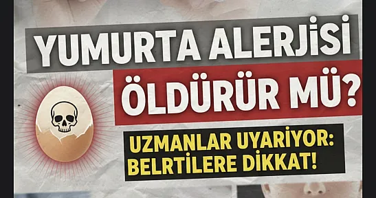 Yumurta Alerjisi Öldürür mü? Uzmanlar Uyarıyor: Anafilaksi Hayati Risk Taşıyor