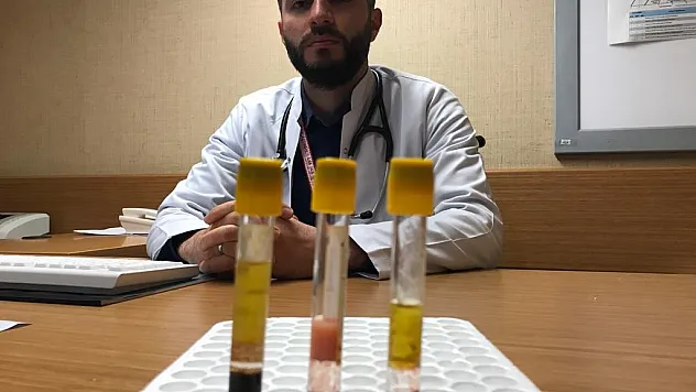 Kolesterolün önemi kanda ortaya çıktı: Düşükte kan berrak, yüksekte bulanık ve katı
