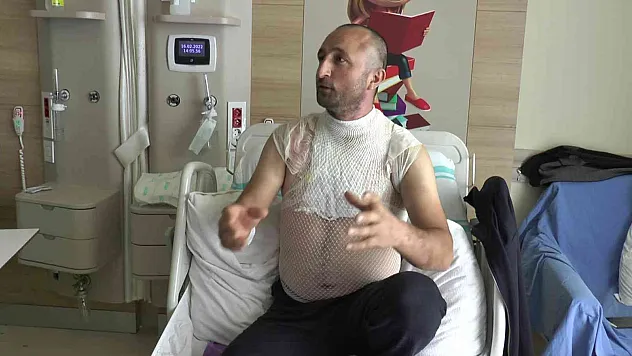 Banyo yaparken kazayla kendini yaktı
