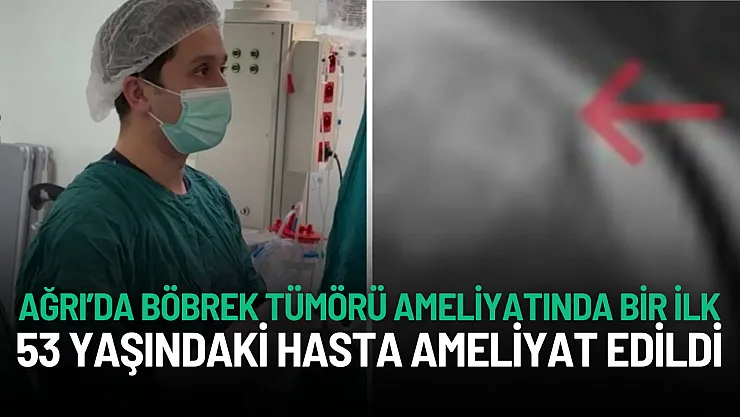 Ağrı Eğitim ve Araştırma Hastanesi'nde Böbrek Tümörü Ameliyatında Bir İlk