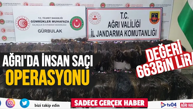Ağrı'da 663 bin lira değerinde insan saçı yakalandı