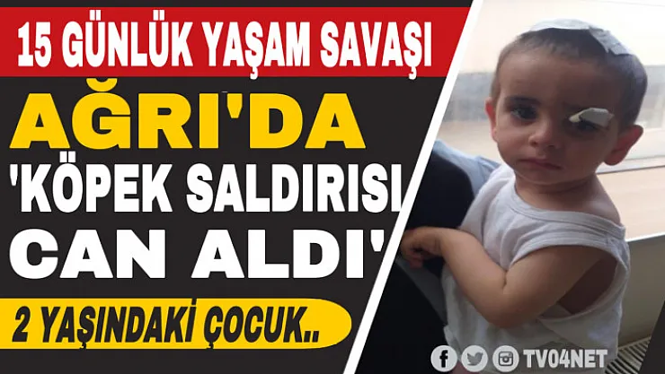 Ağrı'da köpeklerin saldırısına uğrayan minik Asaf hayatını kaybetti
