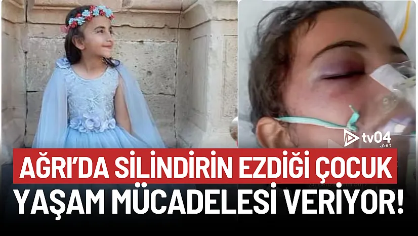 Ağrı'da silindirin ezdiği çocuk yaşam mücadelesi veriyor!