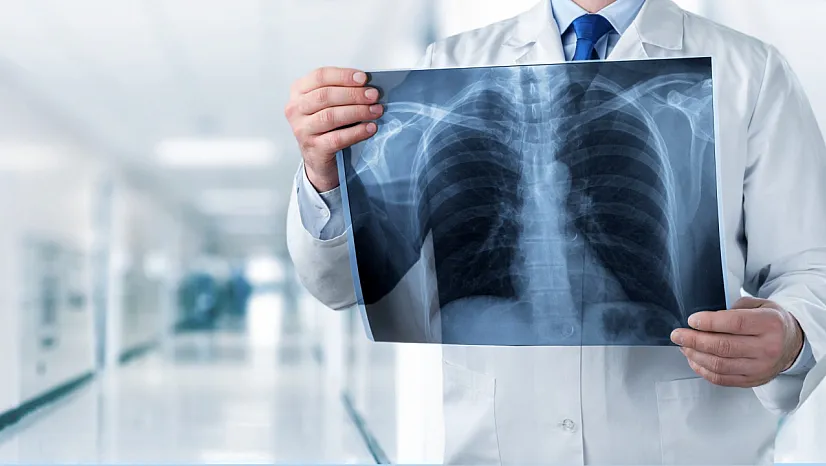 Kronik Obstrüktif Akciğer Hastalığı (KOAH): Artan Risk ve Önleme Yolları