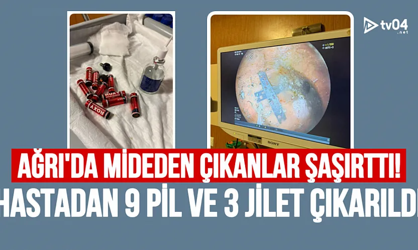 Ağrı'da mide içinde 9 pil ve 3 jilet çıkan hasta ameliyatla kurtarıldı