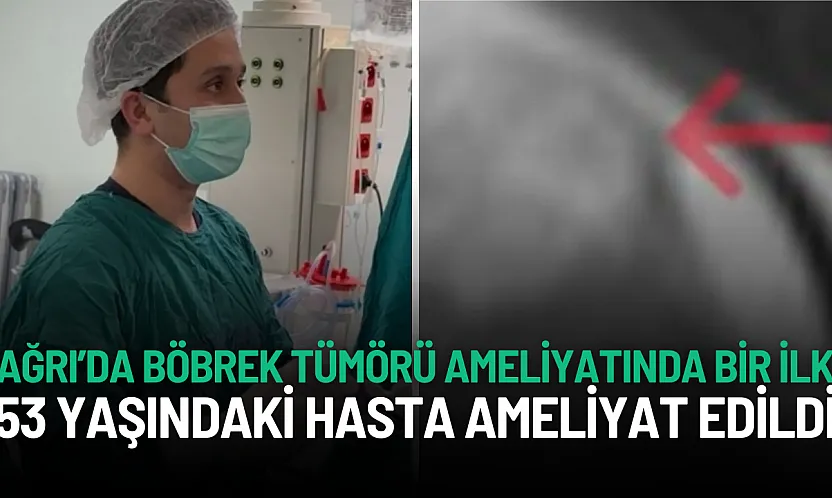 Ağrı Eğitim ve Araştırma Hastanesi'nde Böbrek Tümörü Ameliyatında Bir İlk
